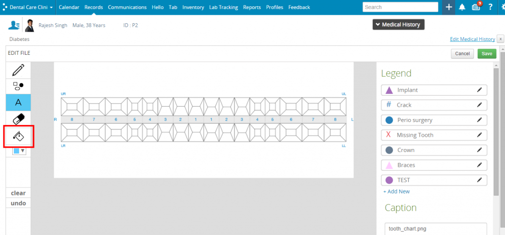 All About Dental Charting – Practo Help